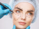 Plastic Surgeon in Jaipur